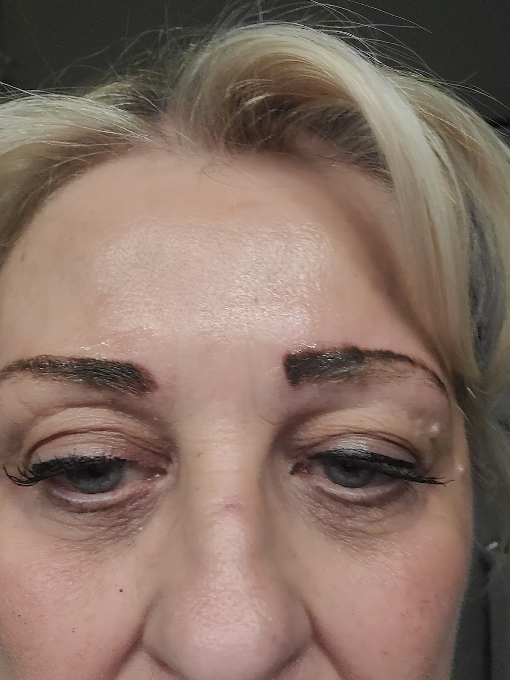 Skin Works Med Spa & Aesthetics | 71 Toronto Rd, Port Hope, ON L1A 3S2, Canada | Phone: (905) 213-6063