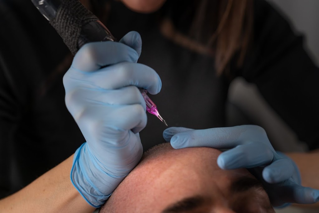 Alpha Scalp | 220 Rue Marius Barbeau, Saint-Joseph-de-Beauce, QC G0S 2V0, Canada | Phone: (418) 397-8407