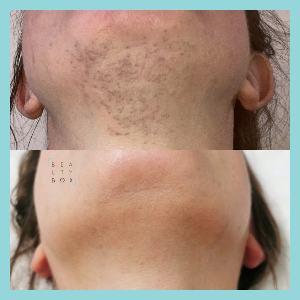Beauty Box | 22 Second St Suite 201, Collingwood, ON L9Y 1E3, Canada | Phone: (705) 994-3811