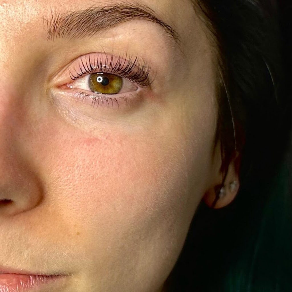 Sophie Esthétique Beauté - Épilation Laser Sherbrooke | 2873 Rue King E, Sherbrooke, QC J1G 5J1, Canada | Phone: (819) 238-9521