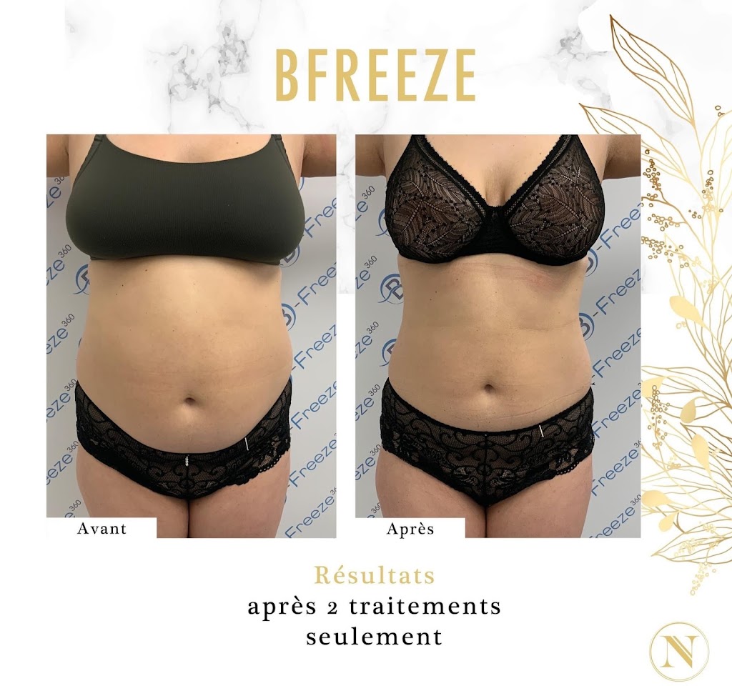 CLINIQUE ESTHÉTIQUE NANCY HUBERT | 4960 Rue Bellefeuille, Trois-Rivières, QC G9A 5Y4, Canada | Phone: (819) 691-2222