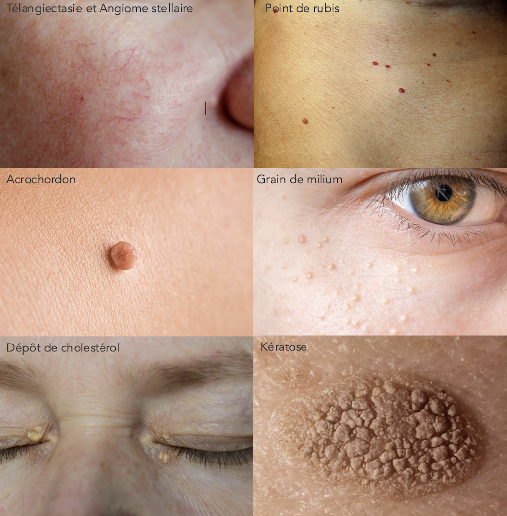 Joanie S. Thétique | 38 Rue Saint-Jacques, Sainte-Agathe-des-Monts, QC J8C 3P1, Canada | Phone: (819) 216-1278