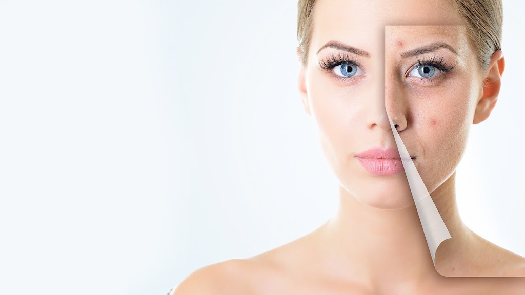 Derma Laser Clinic | 58 Cathedral High St, Markham, ON L6C 0P3, Canada | Phone: (905) 887-8566