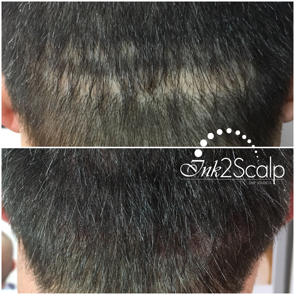 Ink2scalp | 6 Teardrop Crescent, Whitby, ON L1M 2N9, Canada | Phone: (905) 259-1251