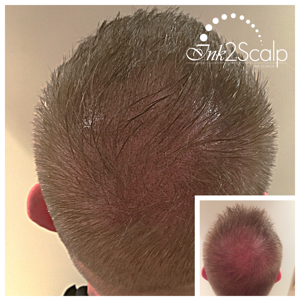 Ink2scalp | 6 Teardrop Crescent, Whitby, ON L1M 2N9, Canada | Phone: (905) 259-1251