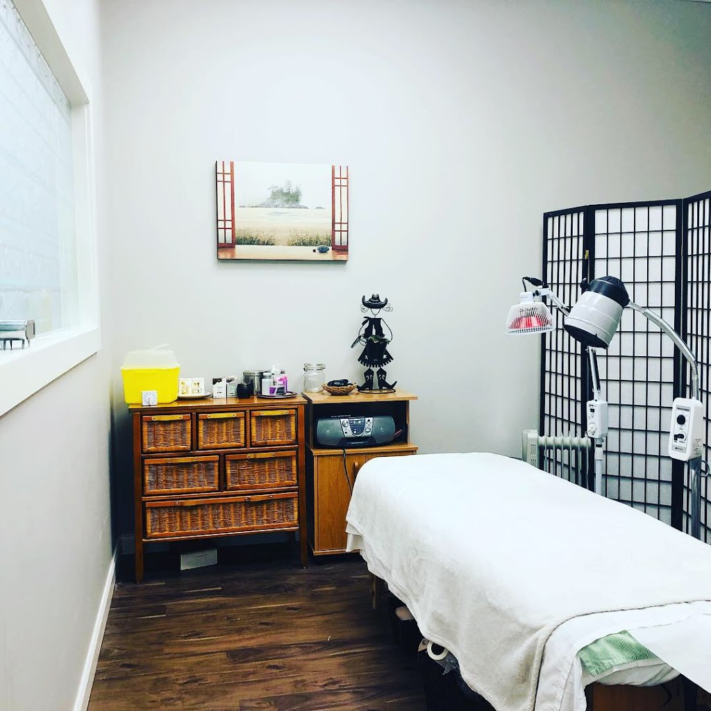Joy’s Acupuncture &Massage | 2615 Kingsway, Vancouver, BC V5R 5H4, Canada | Phone: (604) 764-8275