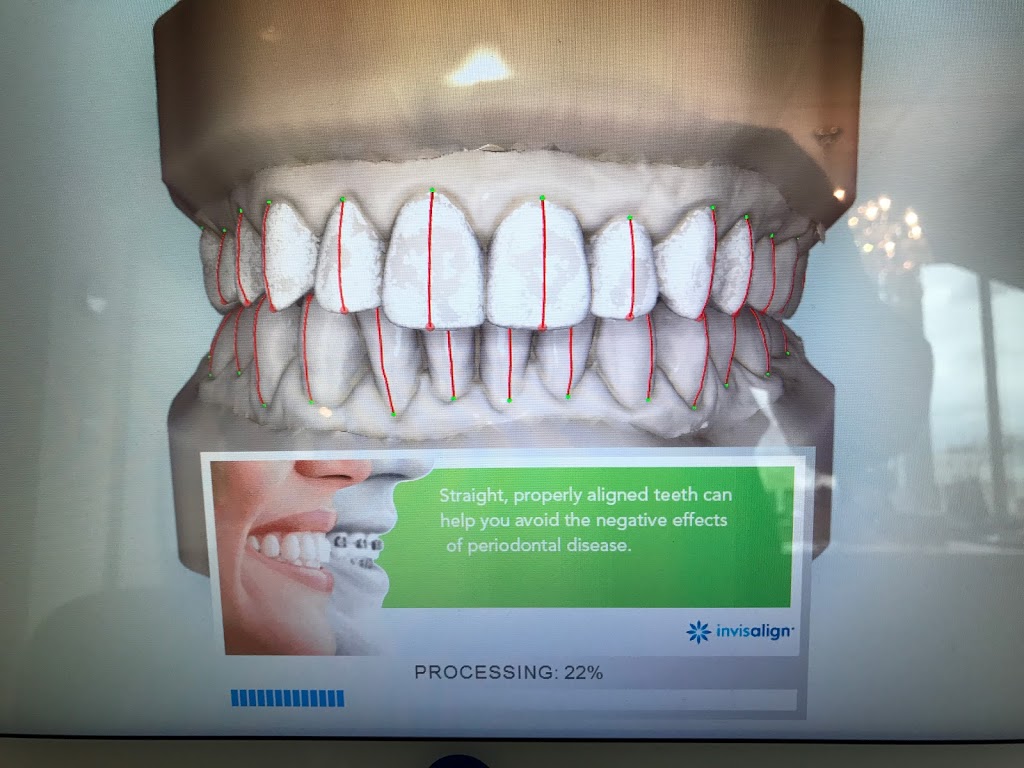 Bayside Dental & Orthodontics | 800 Yankee Valley Blvd SW #305, Airdrie, AB T4B 3Y2, Canada | Phone: (403) 980-4245