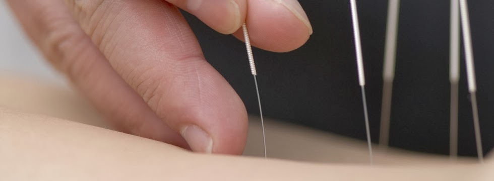 MSK Health and Performance Clinic | 305-4603, Kingsway, Burnaby, BC V5H 4M4, Canada | Phone: (604) 438-6106