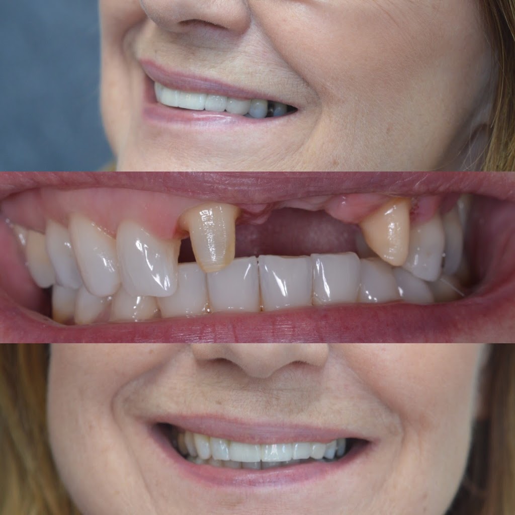 Chois Dental Studio | 1270 King St E, Cambridge, ON N3H 3P8, Canada | Phone: (289) 788-3996