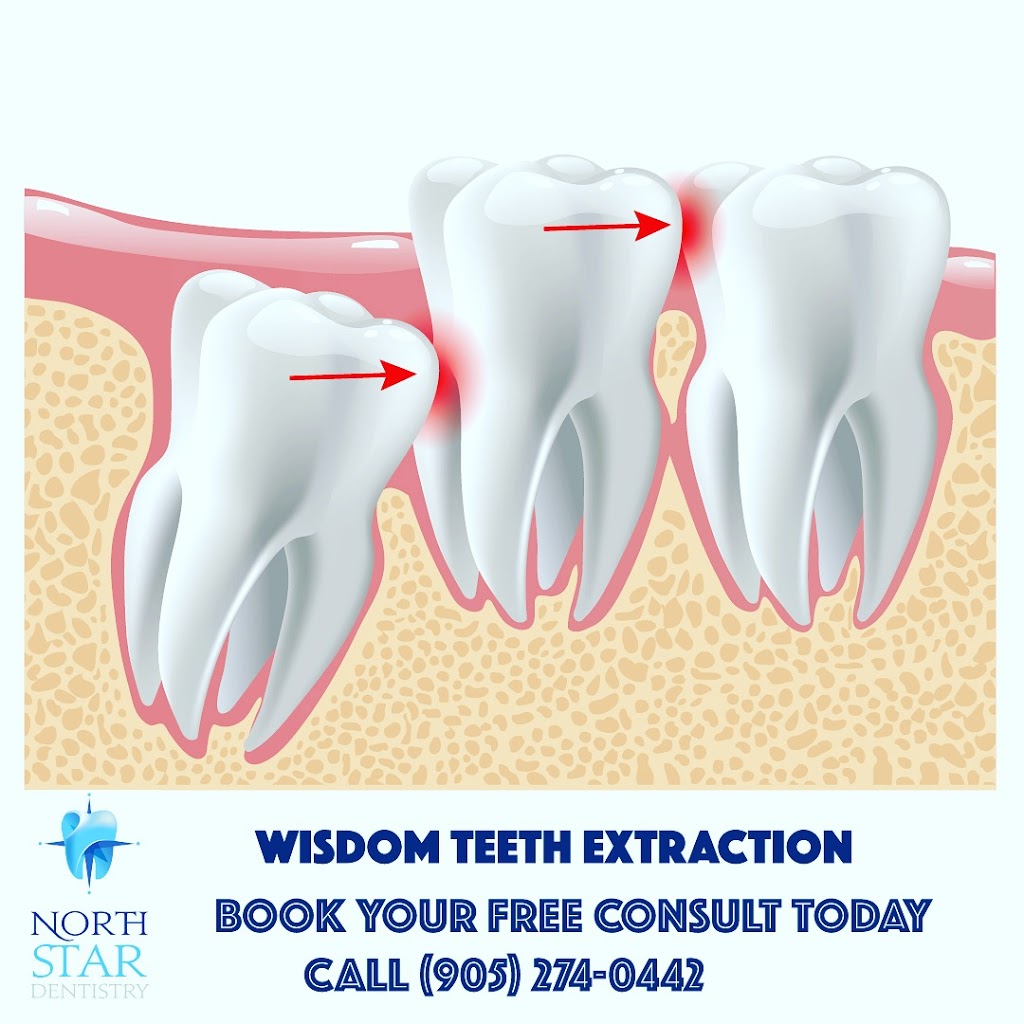 North Star Dentistry | 714 Lakeshore Rd E Unit 5, Mississauga, ON L5G 1J6, Canada | Phone: (905) 274-0442
