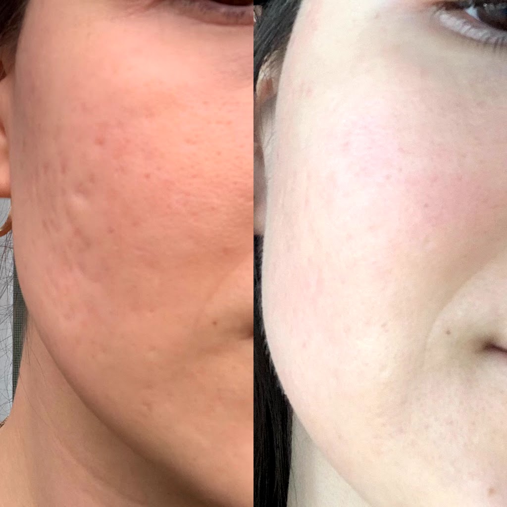 Bare Skin By Teodora | 7008 187 St NW, Edmonton, AB T5T 2W2, Canada | Phone: (780) 297-3242