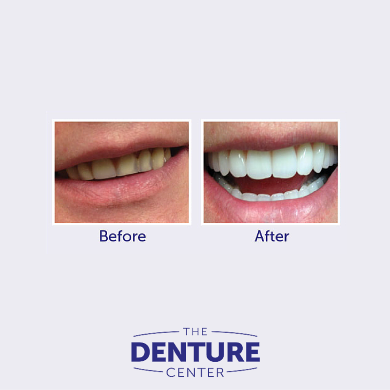 The Denture Center | 2892 S Sheridan Way, Oakville, ON L6J 7L4, Canada | Phone: (905) 829-1033