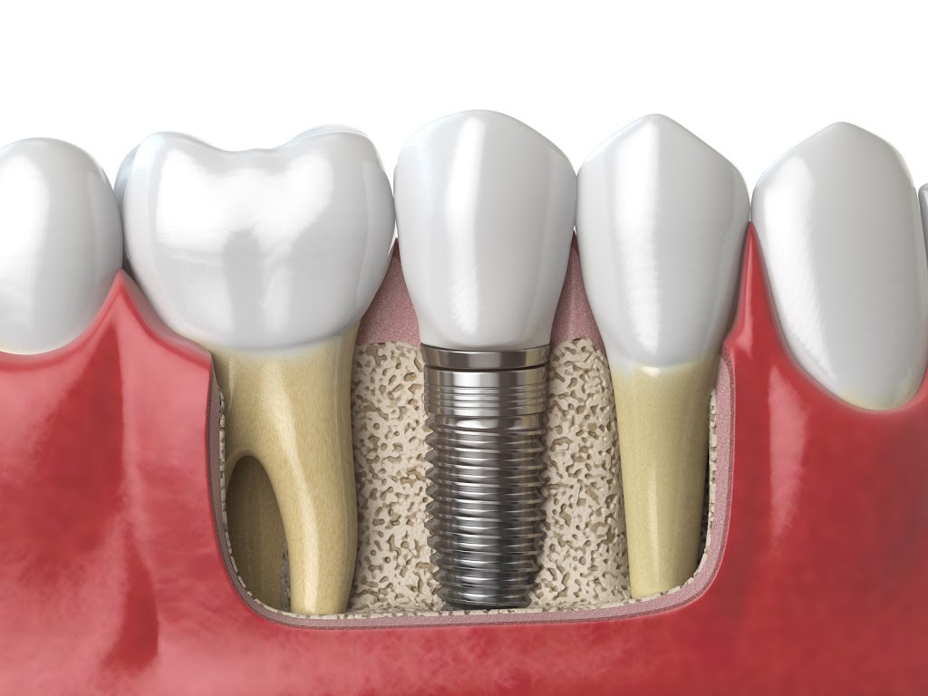Davis Dental Care Newmarket | 105 Davis Dr, Newmarket, ON L3Y 2M9, Canada | Phone: (905) 235-8200
