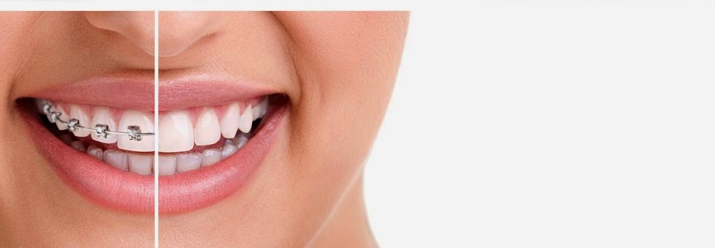 Evergreen Orthodontics | 1960 Como Lake Ave #120, Coquitlam, BC V3J 3R3, Canada | Phone: (604) 671-2255