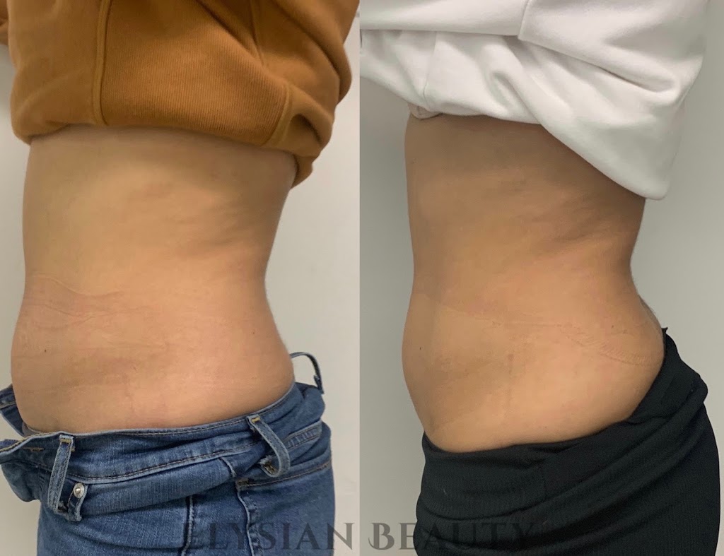 Elysian Beauty | 2838 Gothwood Pl, Gloucester, ON K1T 2V5, Canada | Phone: (613) 700-5551