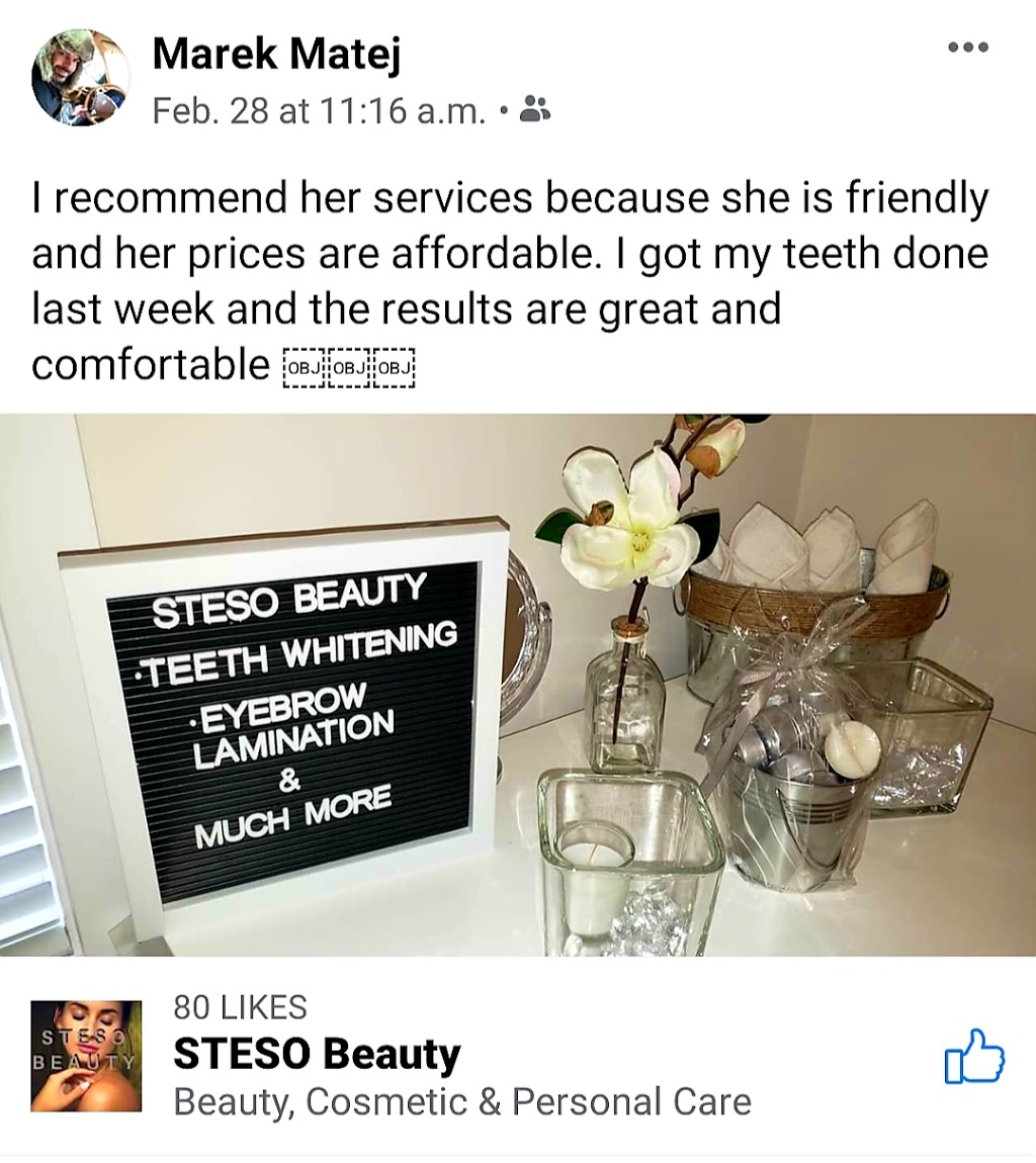 STESO Beauty | 8 Scarletwood St, Stoney Creek, ON L8J 0K8, Canada | Phone: (289) 689-3496