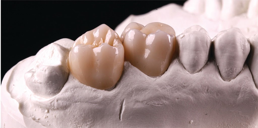 SkyCAD Dental Technology Ltd. (Dental Lab) | 1638 10 Ave SW, Calgary, AB T3C 0J5, Canada | Phone: (403) 970-0600
