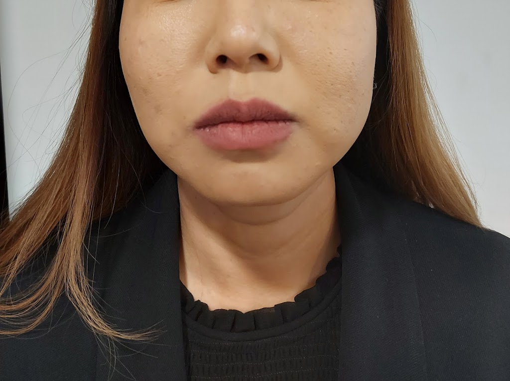 YYC Botox | 1715 10 Ave SW Second floor Unit 205, Calgary, AB T3C 0K1, Canada | Phone: (403) 460-7766