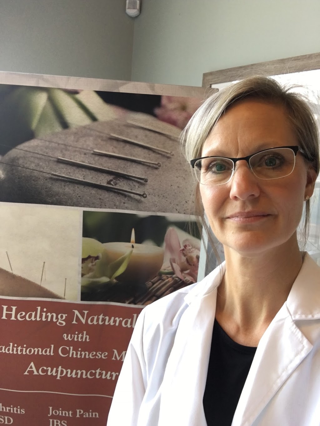 Peterborough West Acupuncture Clinic | 1542 Ireland Dr, Peterborough, ON K9K 2T2, Canada | Phone: (705) 768-2445