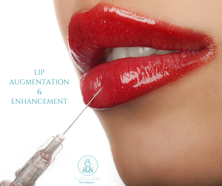 Aphrodite Medispa | 7325 12 St SE, Calgary, AB T2H 2S6, Canada | Phone: (403) 457-9118