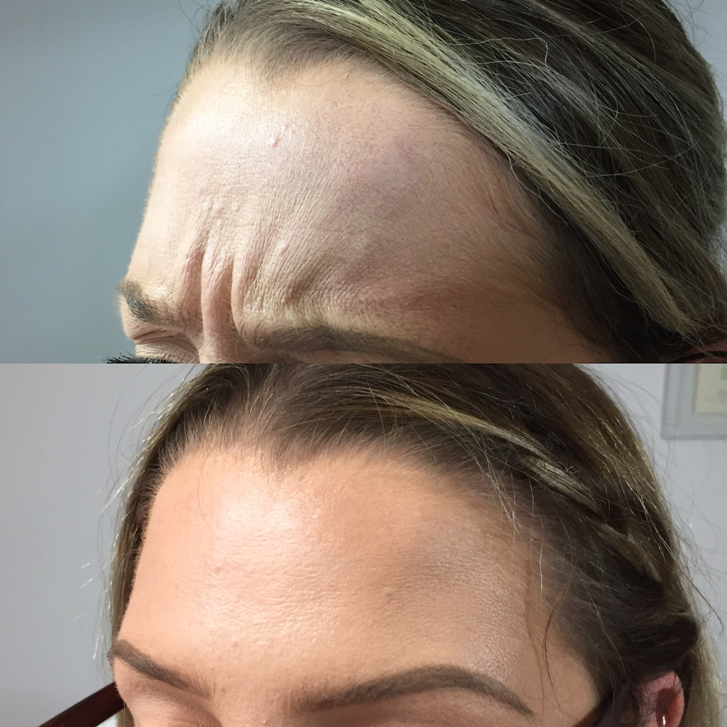 Subtly You - Kitchener Anti-Aging Medical Cosmetic Injections | 40 Benesfort Dr, Kitchener, ON N2N 3B6, Canada | Phone: (519) 994-1387
