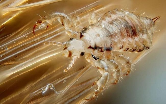 Lice Squad NL | 16 Durdle Dr, Goulds, NL A1S 1A8, Canada | Phone: (709) 325-5423