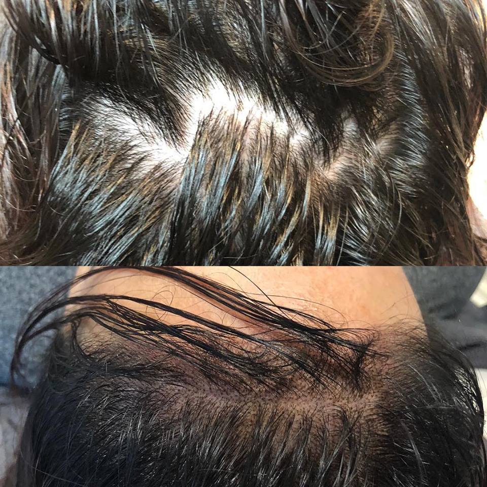 Shayma Rashid- Permanent Makeup , Microneedling and Microblading | 32 Sherbourne Crescent, London, ON N6G 4M1, Canada | Phone: (519) 697-3733