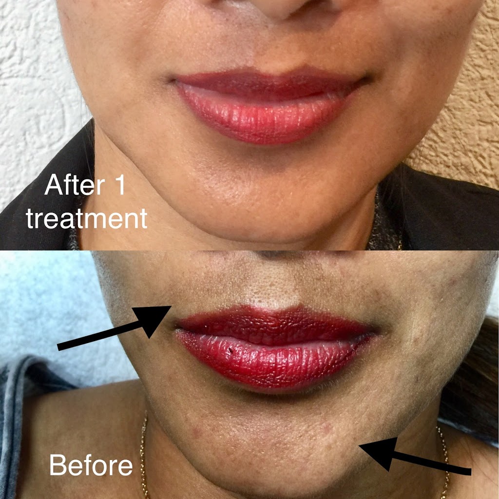 Browlicious Beauty Spa | 830 Rowntree Dairy Rd unit 6, Woodbridge, ON L4L 5V2, Canada | Phone: (647) 848-1111