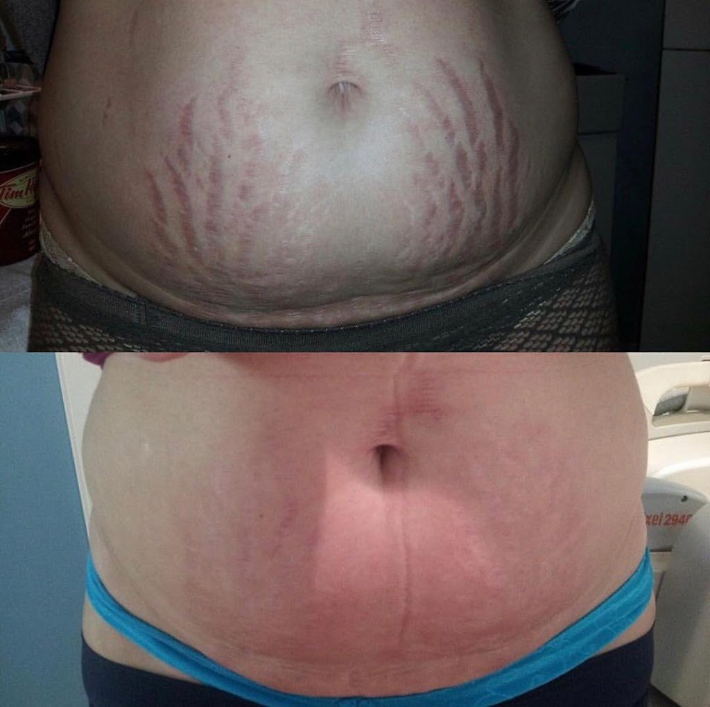 Medic laser and Skin care | 1296 Pacific Blvd, Vancouver, BC V6Z 2V1, Canada | Phone: (604) 633-2474