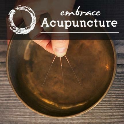 Embrace Acupuncture | 312 Fifth Ave, Cochrane, AB T4C 2A7, Canada | Phone: (403) 678-7970