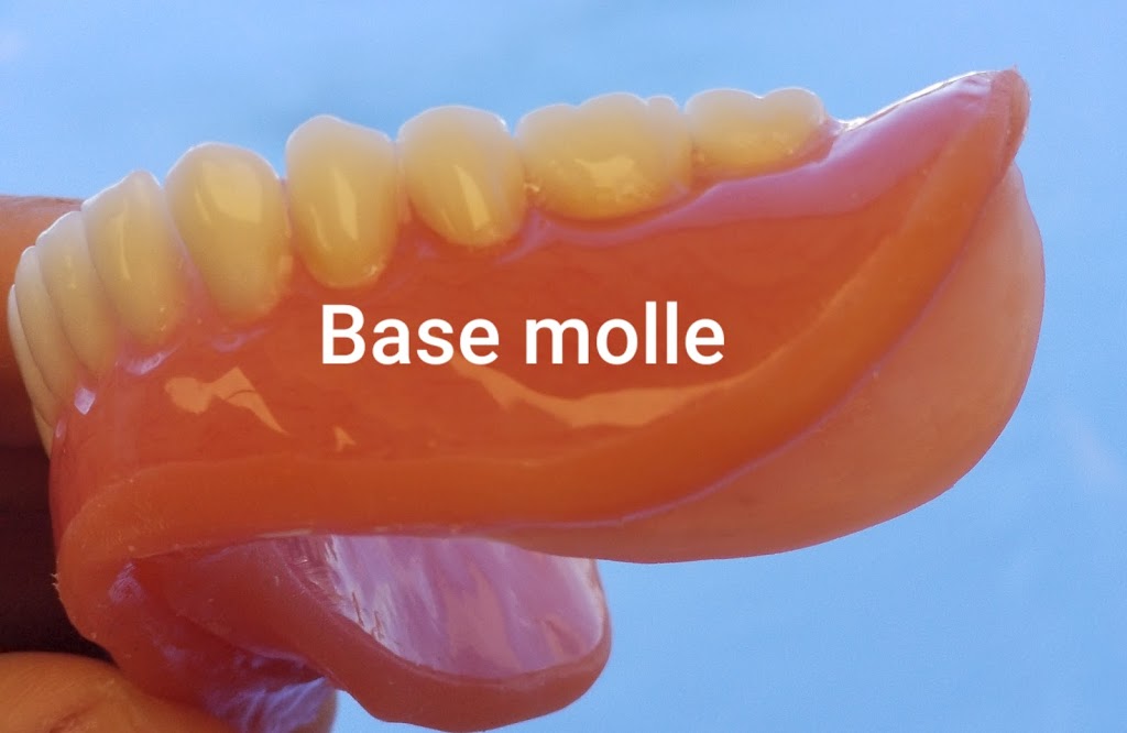 Denturologiste Blainville | Prothèses dentaires Mon Sourire | 391 Boulevard Curé-Labelle, Blainville, QC J7C 2G9, Canada | Phone: (514) 506-4983