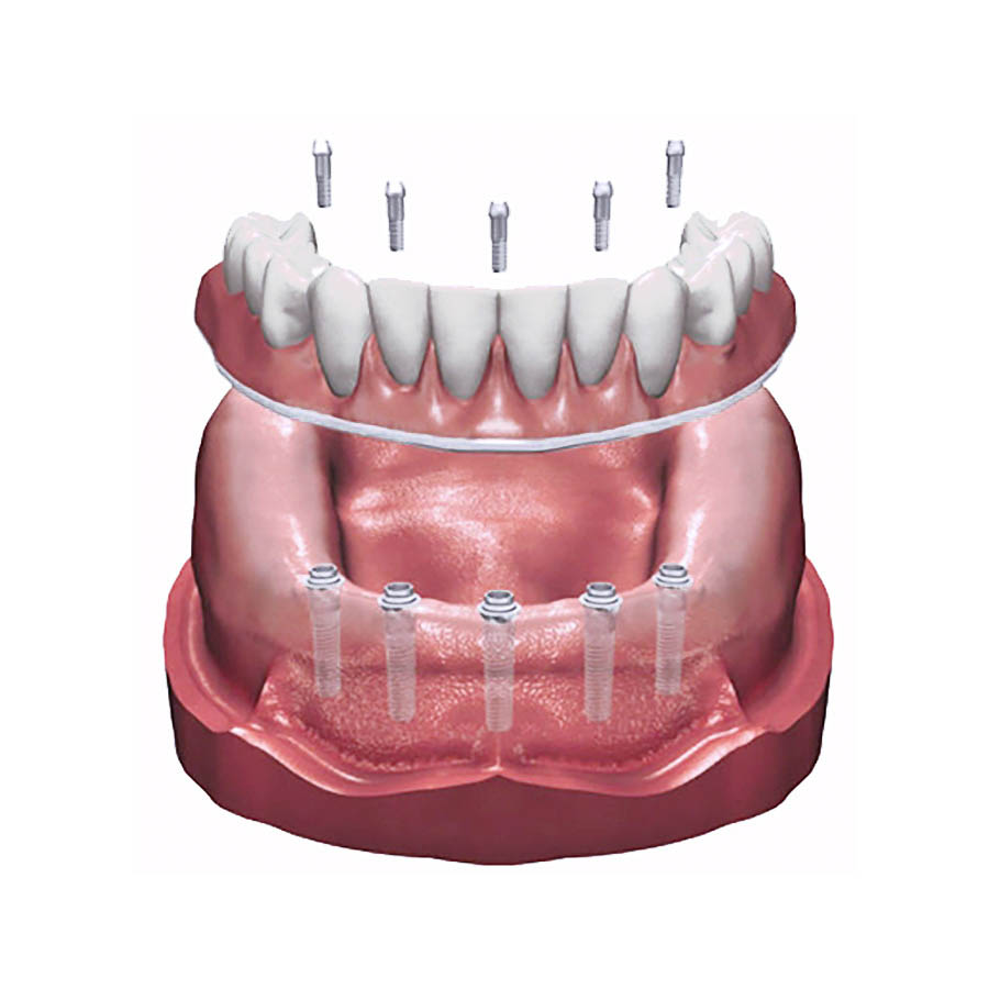 Clinique de Denturologie ProtaDent | 7083 Rue Jarry E #219, Montreal, QC H1J 1G3, Canada | Phone: (514) 312-2909
