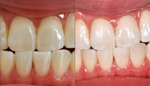 Stouffville Smiles Dentistry | 5710 Main St #3, Whitchurch-Stouffville, ON L4A 8A9, Canada | Phone: (905) 591-5599