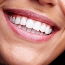 Smile Spa Teeth Whitening | 452 Birch Bear Run, Lewis Lake, NS B3Z 4B8, Canada | Phone: (902) 444-1391