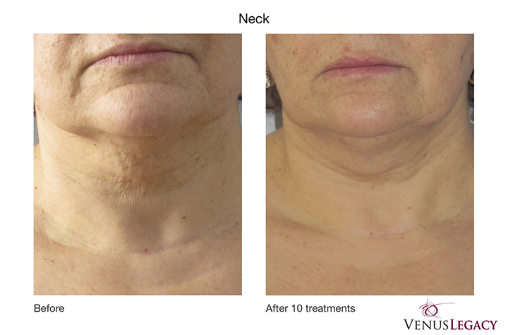 Enhanced by Milo | Classic Dr, London, ON N5W 5T9, Canada | Phone: (519) 619-9229