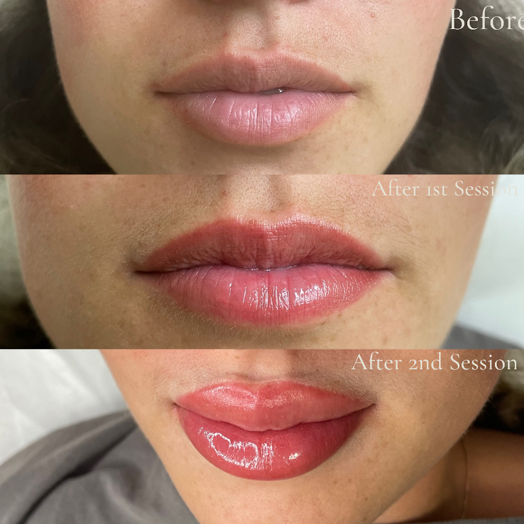 Natali Lischinski Medical Aesthetics & Cosmetic Tattoo | 8 Cooks Mill Crescent, Maple, ON L6A 0K8, Canada | Phone: (416) 700-3855