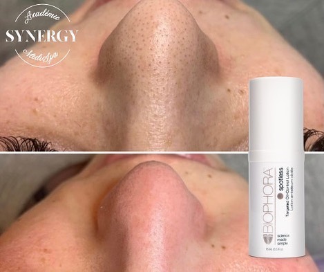 EsthetiqueKP | 253 Rue Caron, Ham-Nord, QC G0P 1A0, Canada | Phone: (450) 881-5703
