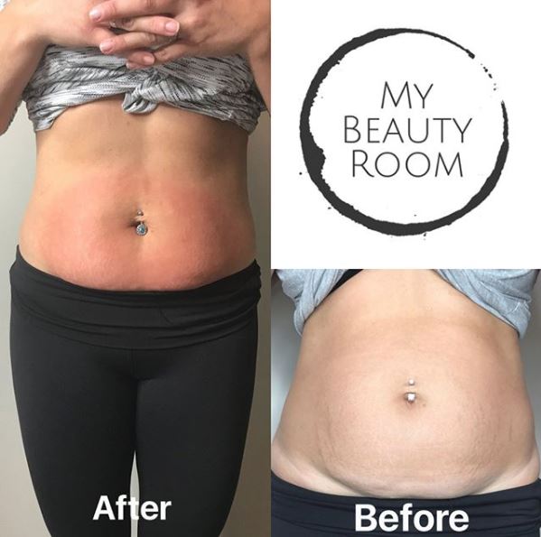 My Beauty Room Spa & Nails | 999 Alliance St, LaSalle, ON N9H 0C4, Canada | Phone: (519) 992-6713