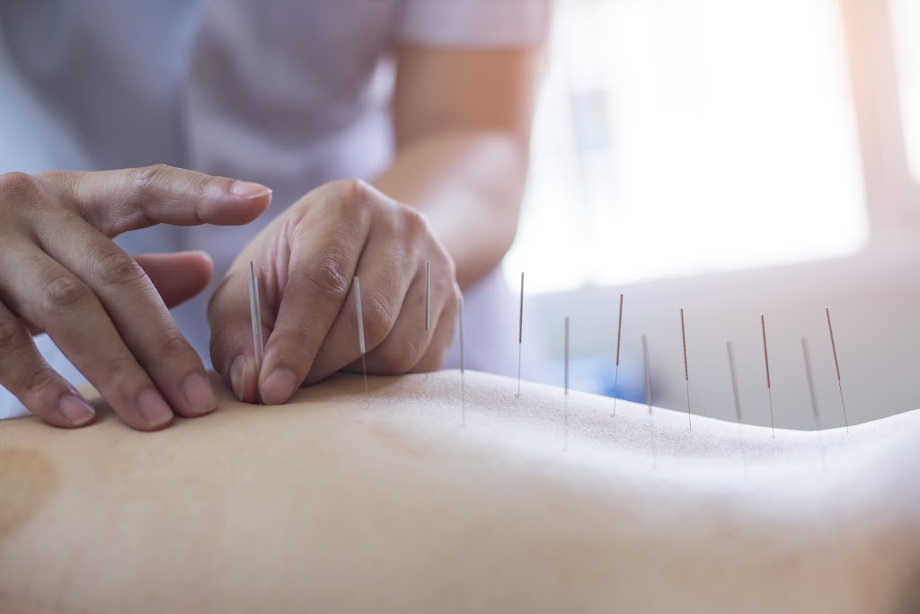 Acupuncture holistique - Christian Vyboh, acupuncteur | 222 Boul Henri-Bourassa E #30-1, Montréal, QC H3L 1B9, Canada | Phone: (514) 436-0405
