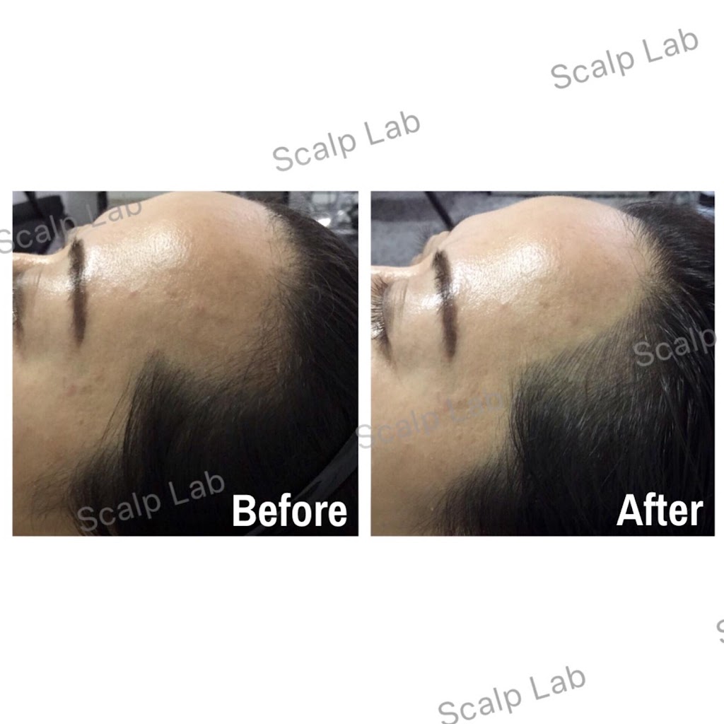 Scalp Lab | 135 Village Green Square, Scarborough, ON M1S 0G4, Canada | Phone: (416) 823-9300
