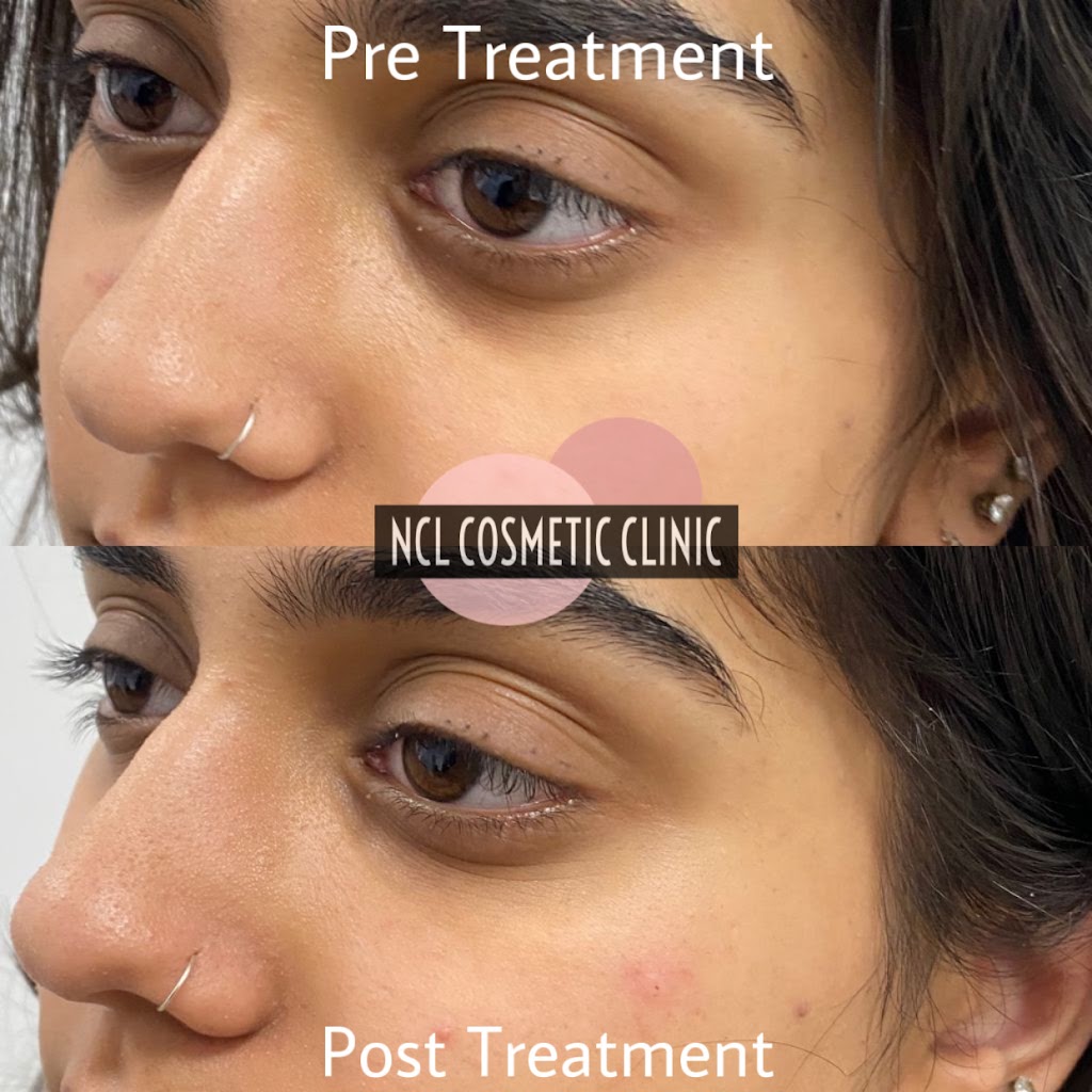 NurseCare Link Inc | 14 Automatic Rd UNIT #30, Brampton, ON L6S 5N5, Canada | Phone: (647) 405-1412