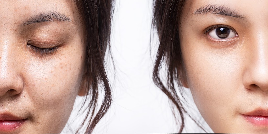 Dermal Essence | 44 Terr. Bellerive, Lavaltrie, QC J5T 1A6, Canada | Phone: (819) 470-8094