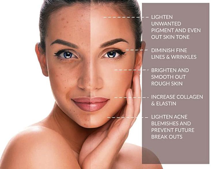 Spa On Elm | 21 Elm St, Burks Falls, ON P0A 1C0, Canada | Phone: (613) 323-1993