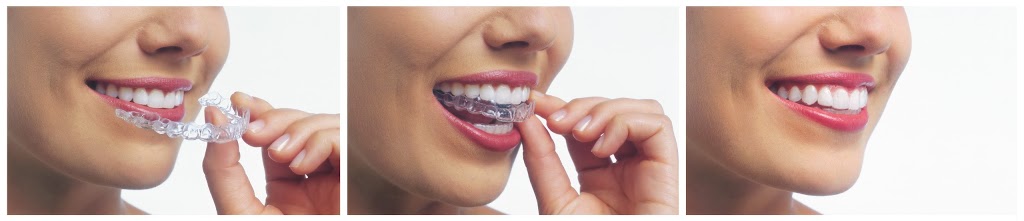 Fallowfield dental | 3350 Fallowfield Rd #6, Nepean, ON K2J 5L1, Canada | Phone: (613) 440-9000