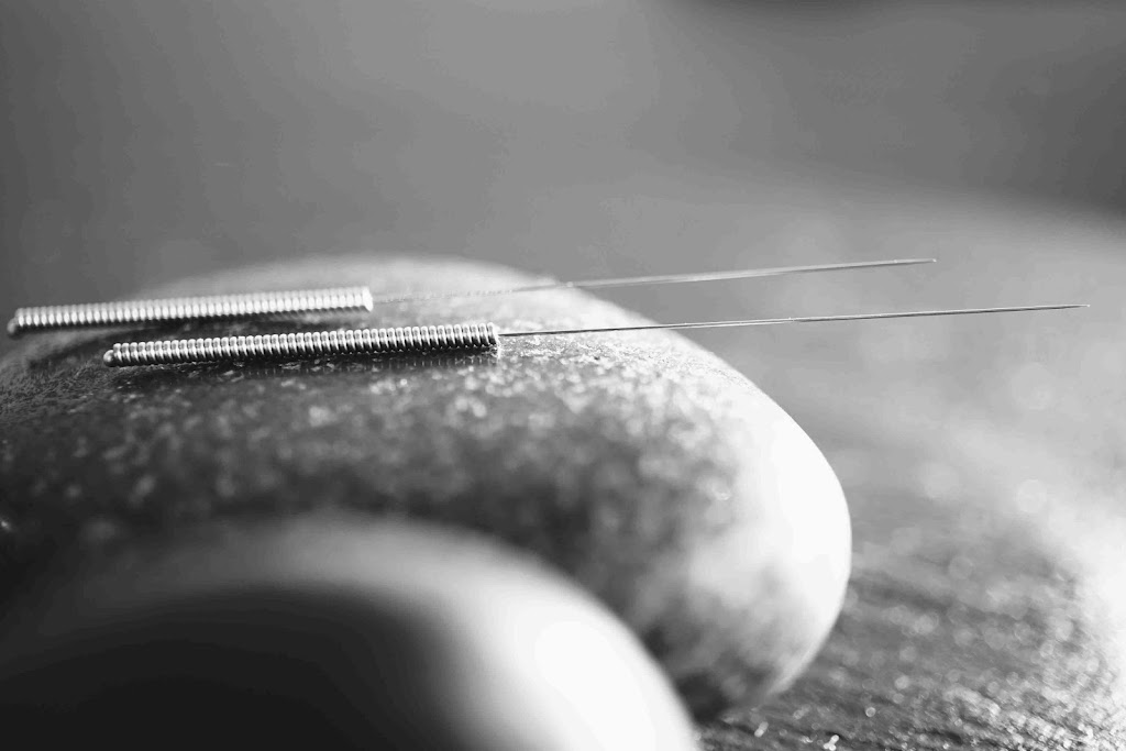Silver Fern Acupuncture + Herbal Clinic | 1313 7th Ave #304, Invermere, BC V0A 1K0, Canada | Phone: (250) 919-6535