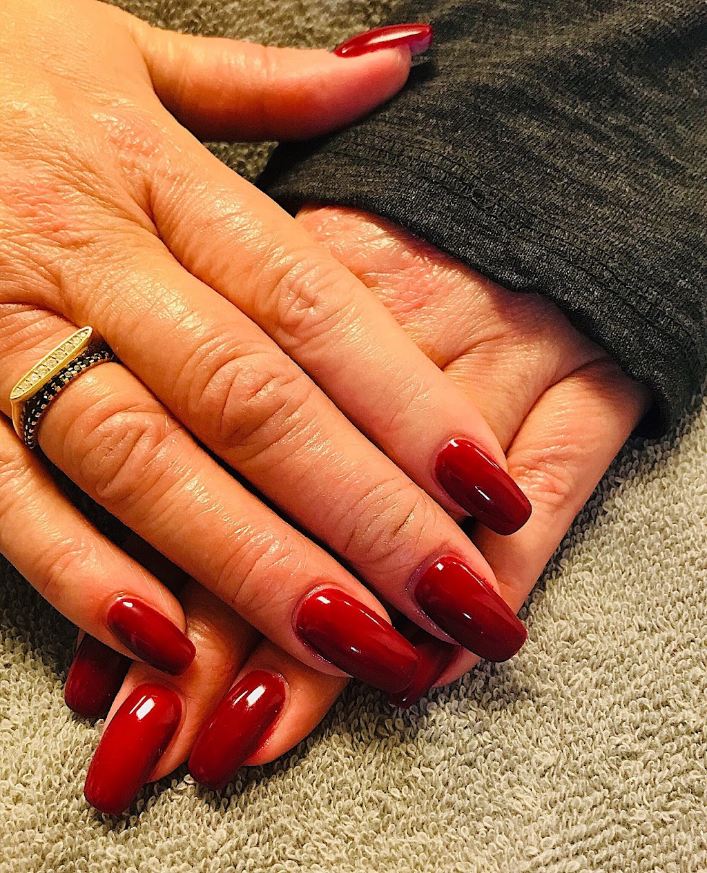 Simply Beautiful Esthetics | 4 Forest Hills Pkwy, Cole Harbour, NS B2W 5G7, Canada | Phone: (902) 435-1300