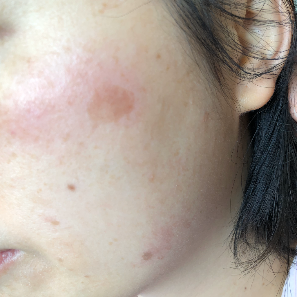 Fountain Laser Clinic | 9425 Leslie St #14a, Richmond Hill, ON L4B 3N7, Canada | Phone: (416) 625-1736