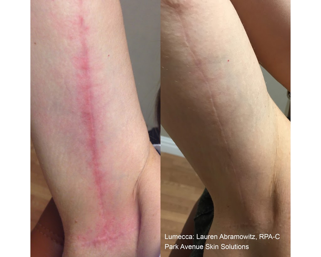 Elan Laser Aesthetics | 2258 Belmont Ct, Burlington, ON L7P 3N3, Canada | Phone: (905) 220-2258