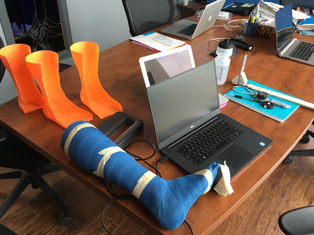 Boundless Biomechanical Bracing | 2601 Matheson Blvd E #9, Mississauga, ON L4W 5A8, Canada | Phone: (905) 602-0650