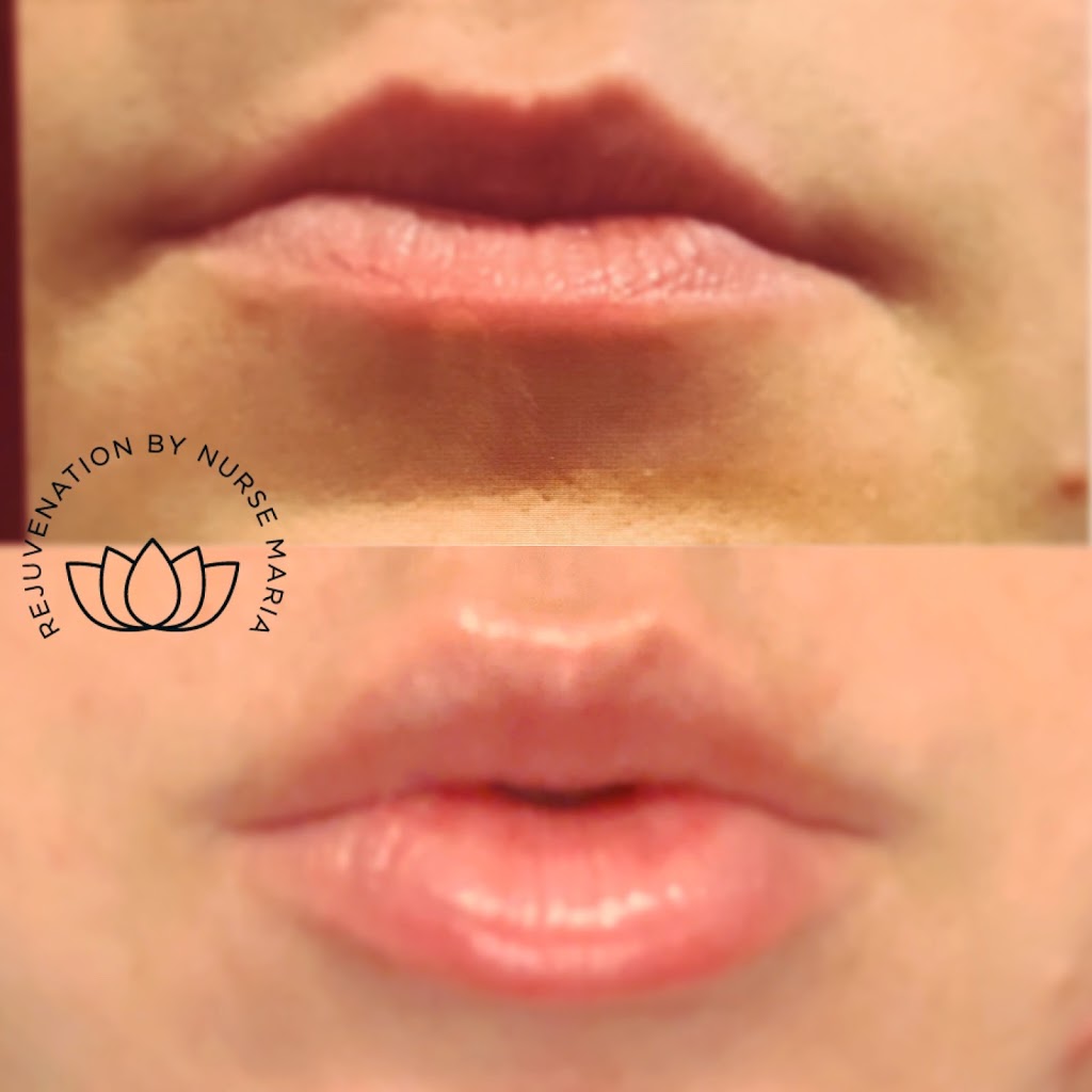 New Tec Cosmetic Rejuvenation | 35 Wolfe Ave Tottenham L0G1W0, 100 Bass Pro Mills Dr Unit 42, Vaughan, ON L4K 5X1, Canada | Phone: (416) 605-3646